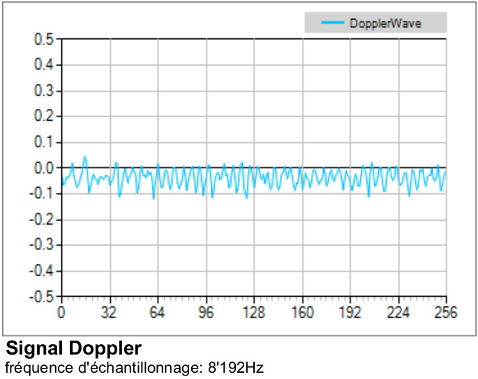 Signale Doppler